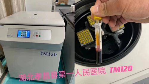 Latest company news about PRP centrigue