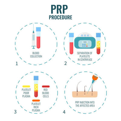 Veterinary Medicine:** Process animal blood for PRP therapies in equine and canine sports medicine.